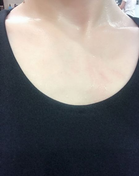 刺猬免费观看_720手机在线观看